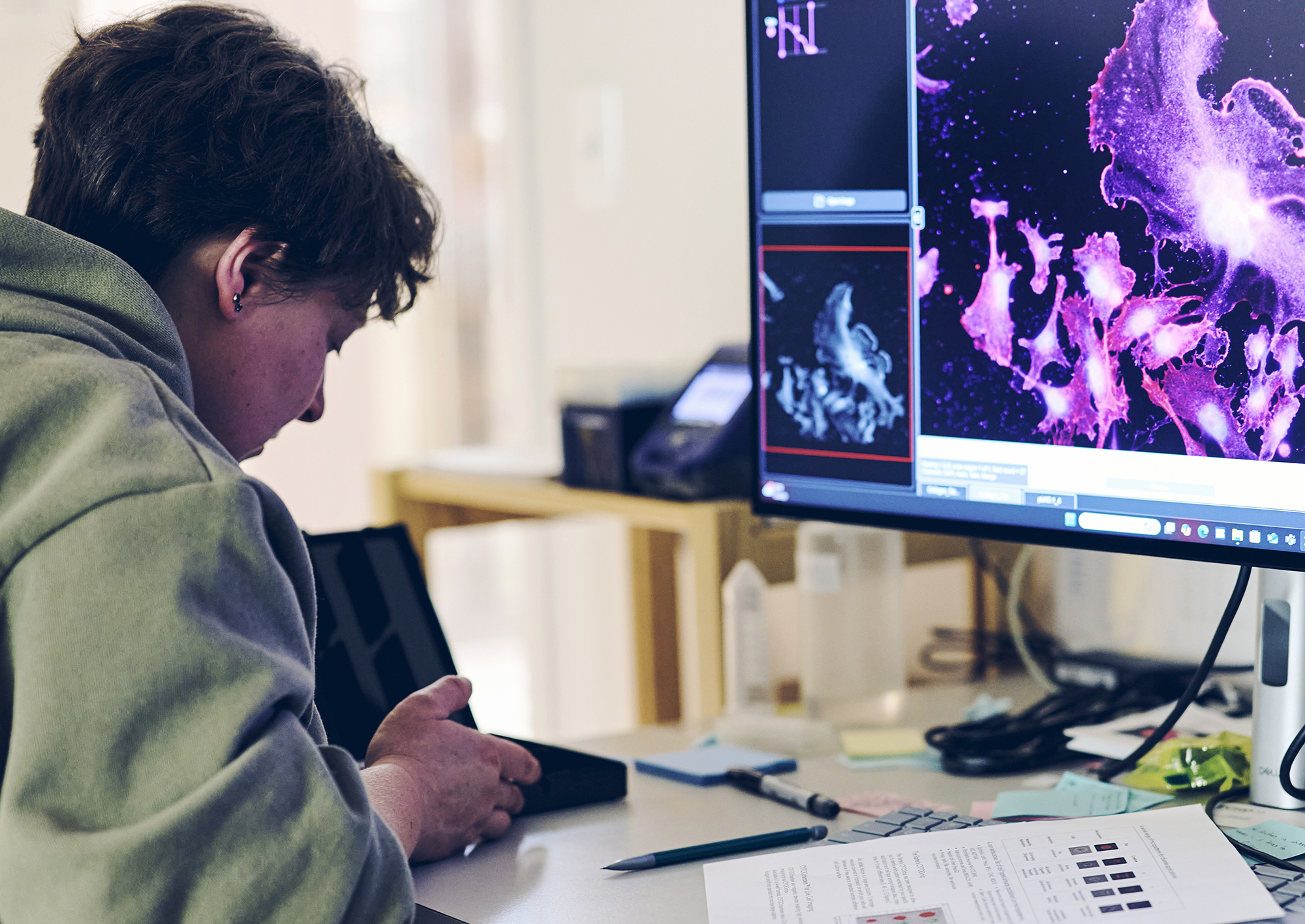 Student looking at breast cancer